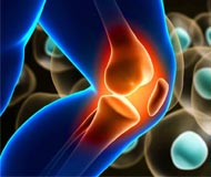 Terapia Regenerativa Y Plasma Rico En Plaquetas Salud Plena Alternativa Ibague